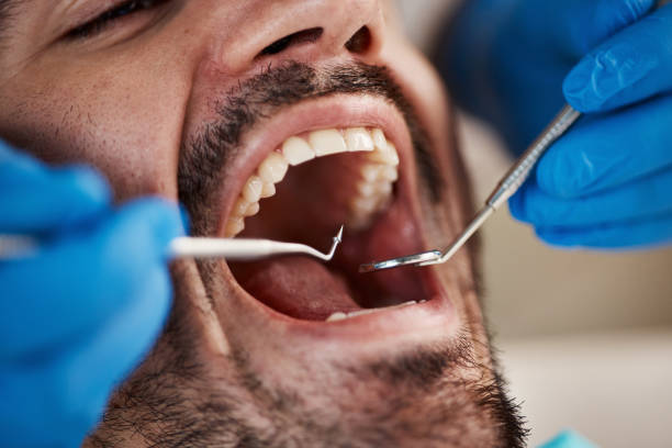Best Dental Inlays and Onlays  in Three Way, TN
